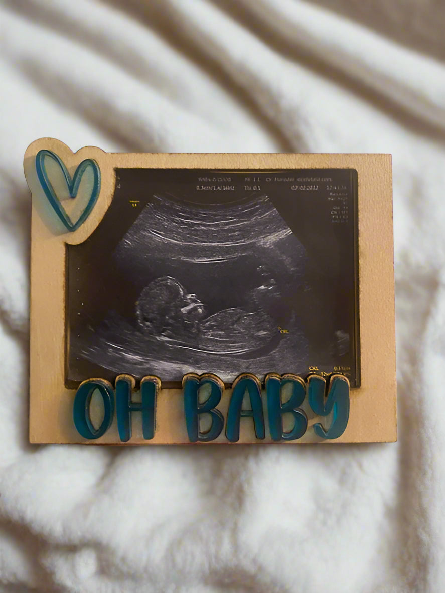 Ultrasound Fridge Magnets
