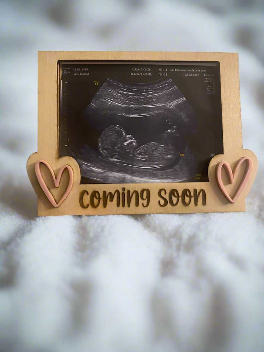 Ultrasound Fridge Magnets
