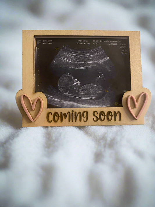 Ultrasound Fridge Magnets